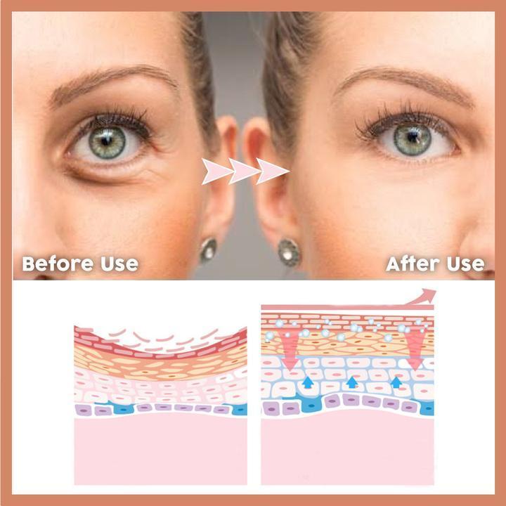 EyeFresh - Eye Boosting Serum