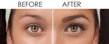 LovelyLashes - Eyelash Growth Serum